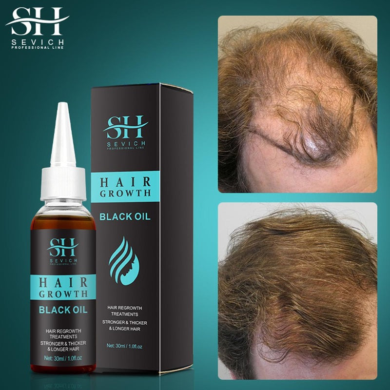 Hair Growth Black Oil - Sevich