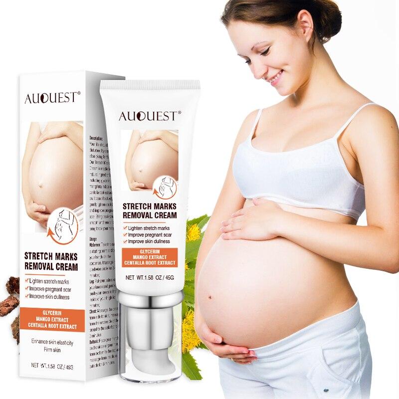 Stretch Marks Removal Cream - Auquest